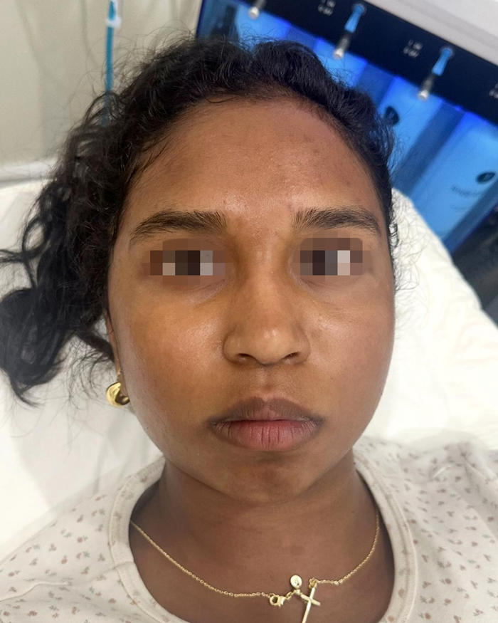 After Skin Hydration & Glow