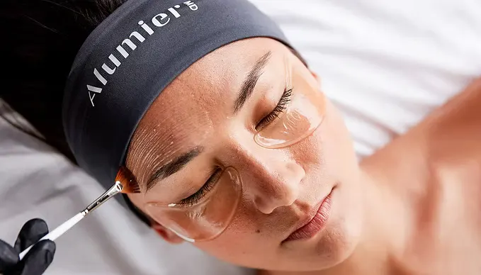 Chemical peels treatment