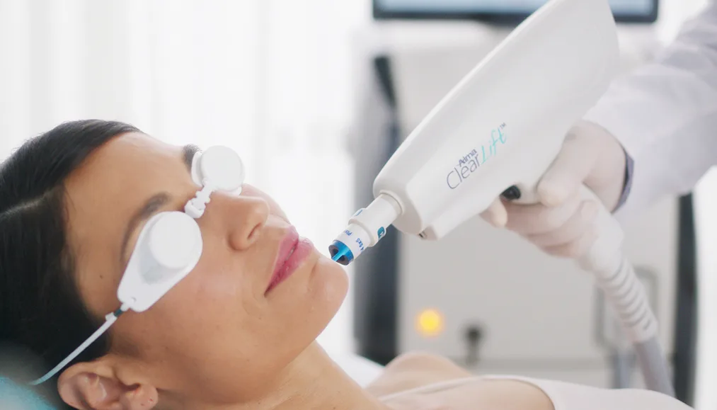ClearLift laser treatment