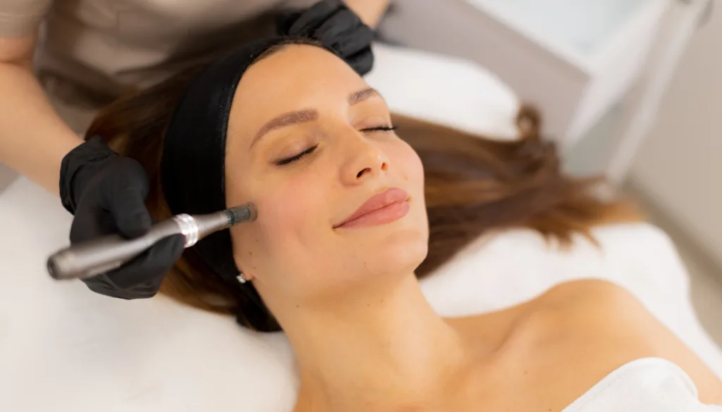 Microneedling treatment