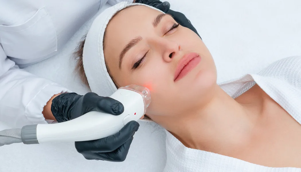 Opus Plasma RF treatment